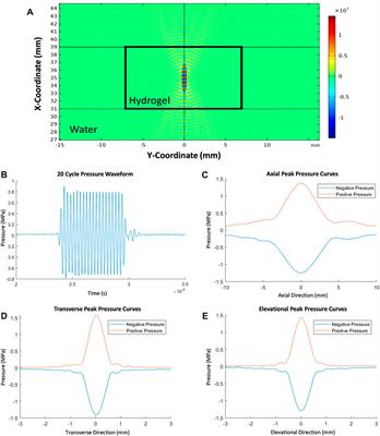 Focused ultrasound for the remote modulation of nitric oxide release from injectable PEG-fibrinogen hydrogels for tendon repair